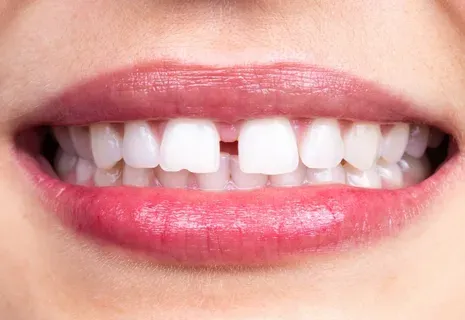 dental clinic in Madurai 