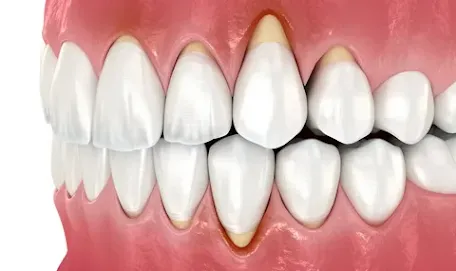 dental clinic in Madurai 