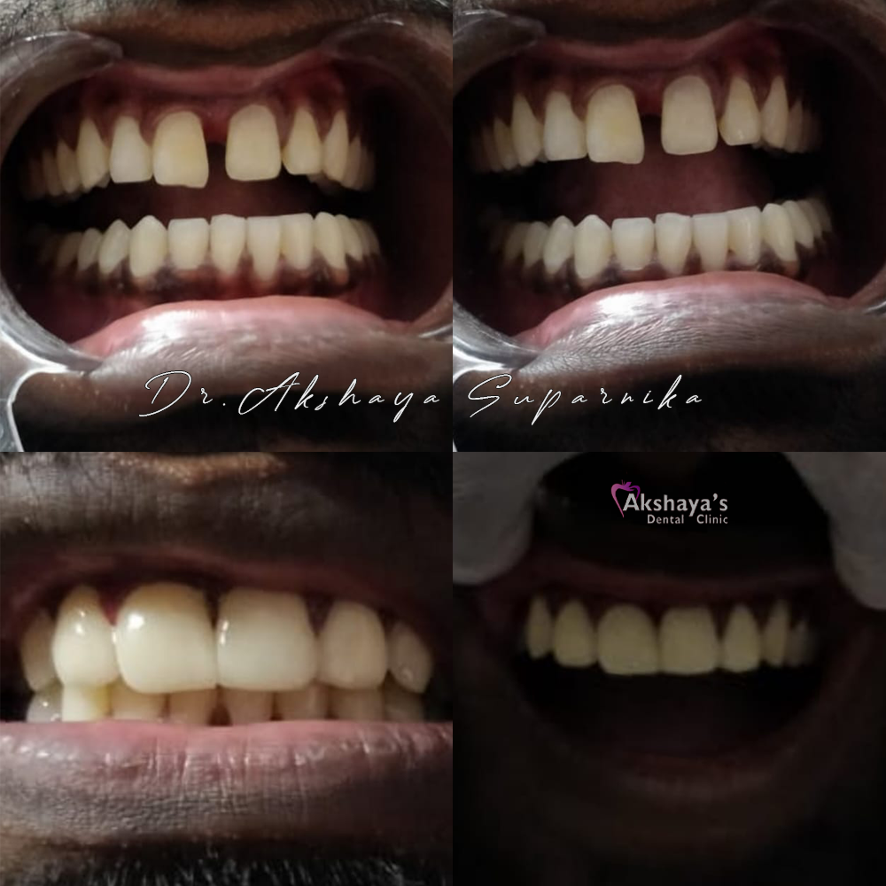 dental hospital Madurai