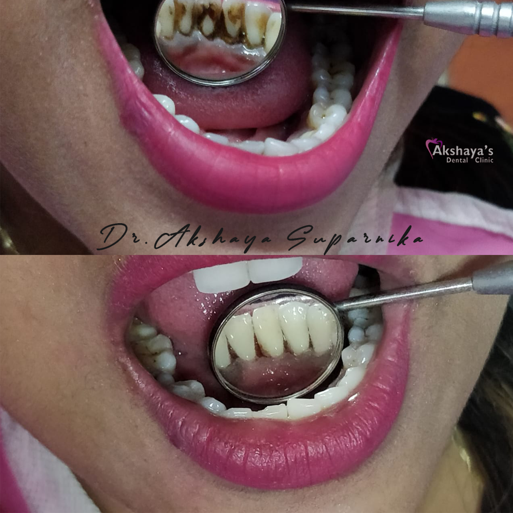 dental hospital Madurai