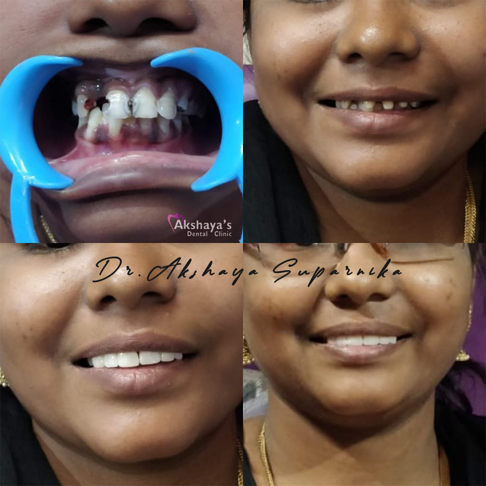 dental hospital Madurai