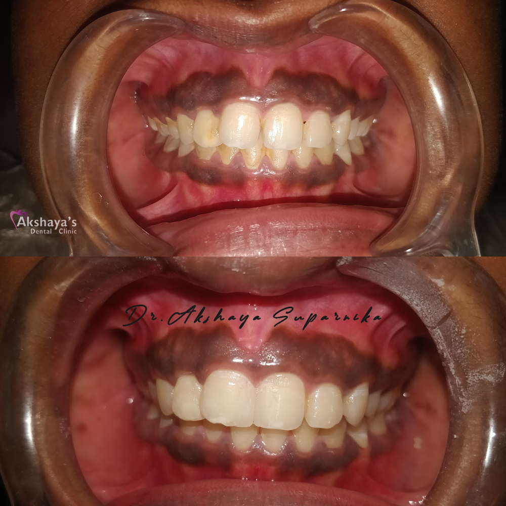 dental hospital Madurai