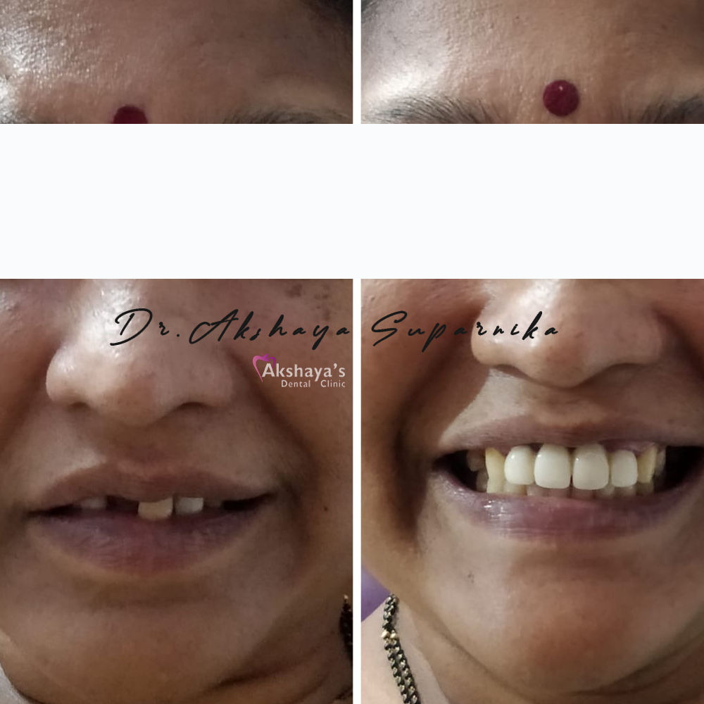 dental hospital Madurai