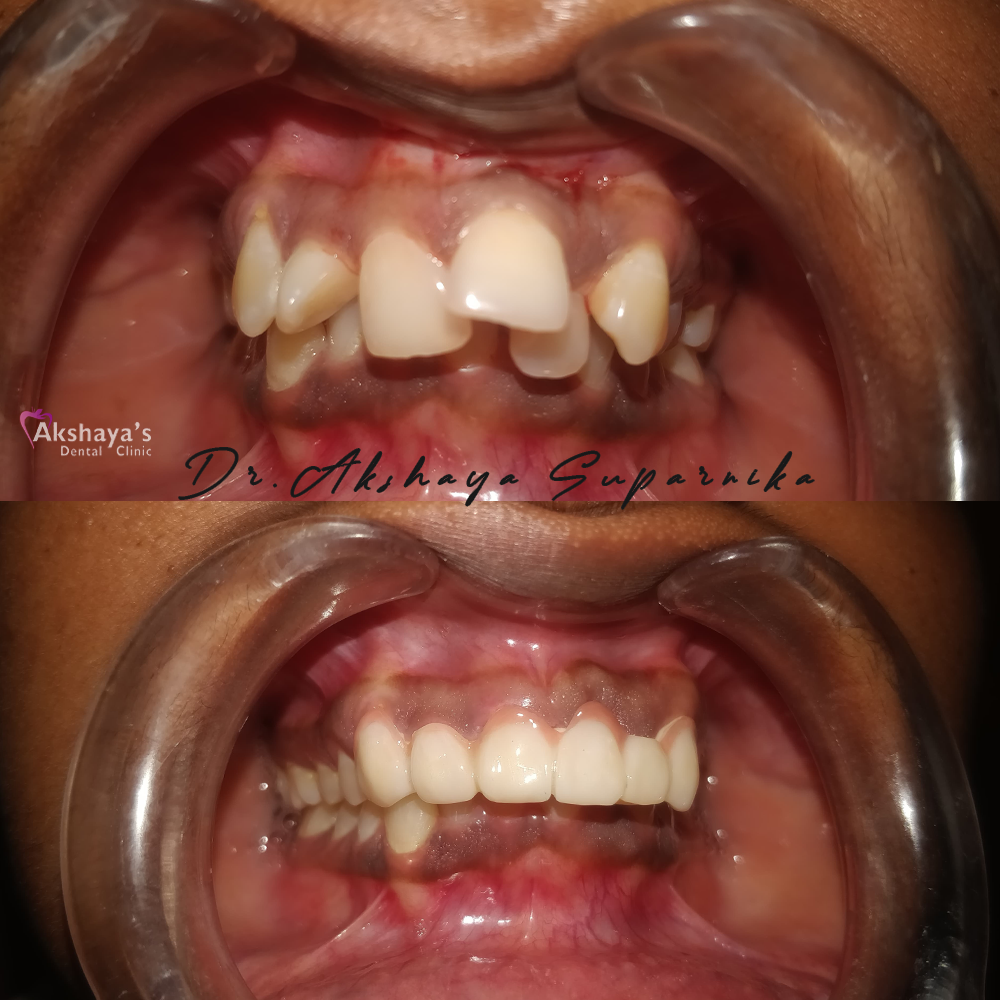 dental hospital Madurai