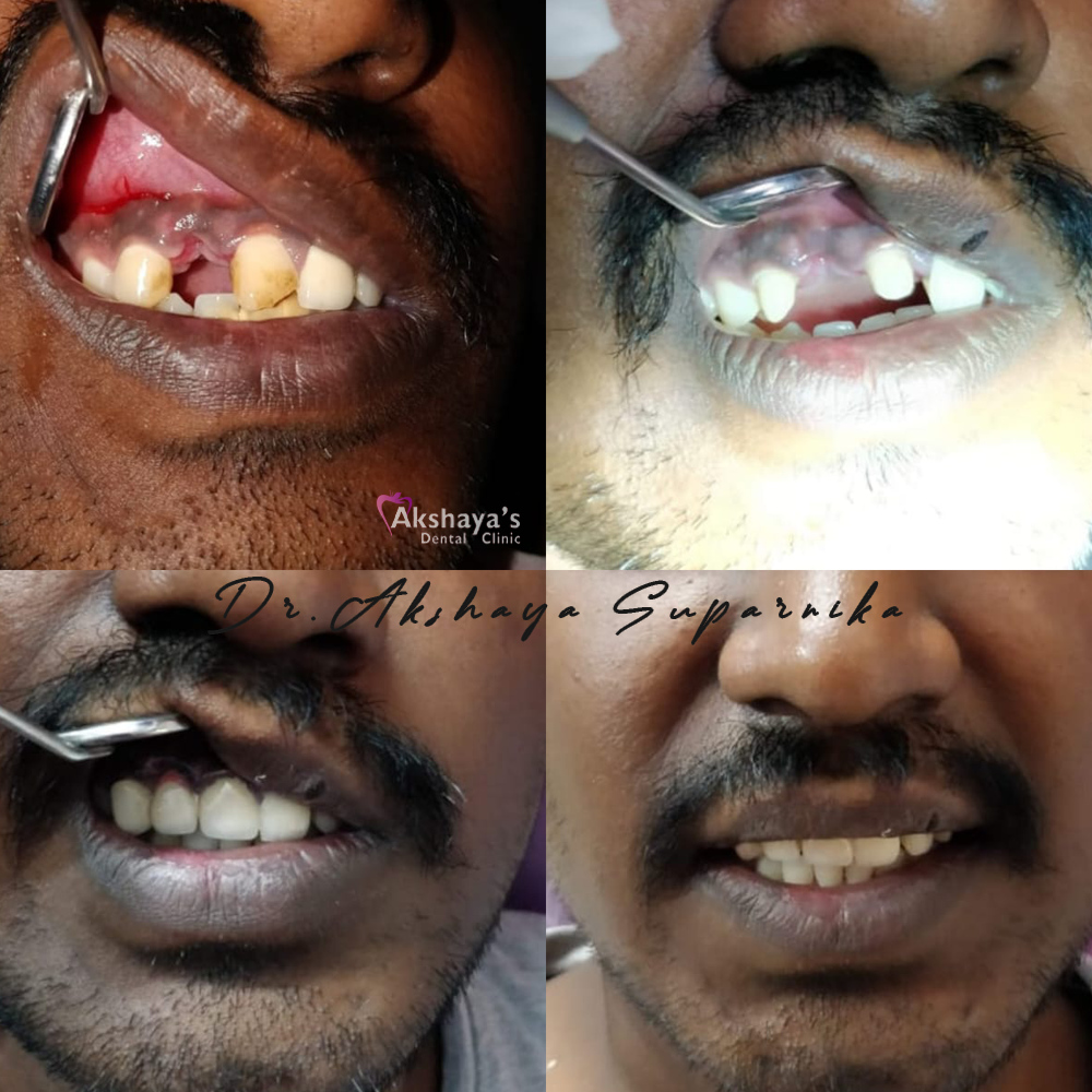 dental hospital Madurai