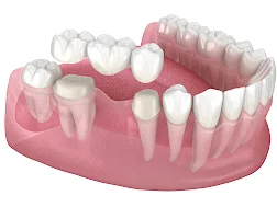 Dental Clinic in Anna Nagar Madurai